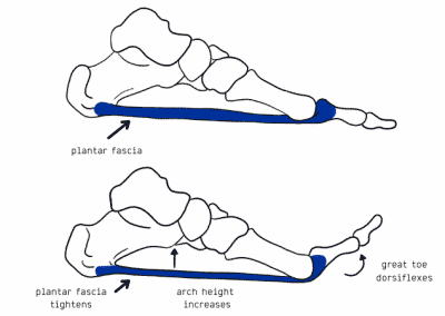 About Orthotics