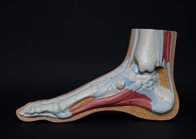 Common Questions about Podiatry