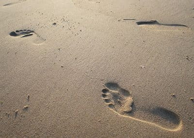 What is a Tailor’s Bunion – Diagnosis, Treatment and Pain Relief