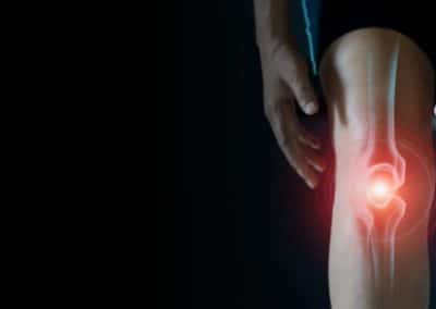 What is Osgood Schlatters Disease – Diagnosis, Treatment and Pain Relief