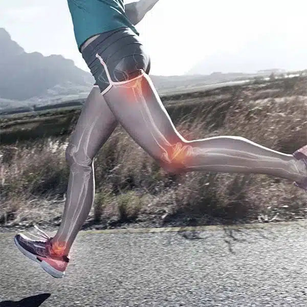 What is Knee pain /Patella Femoral Pain Syndrome – Diagnosis, Treatment and Pain Relief