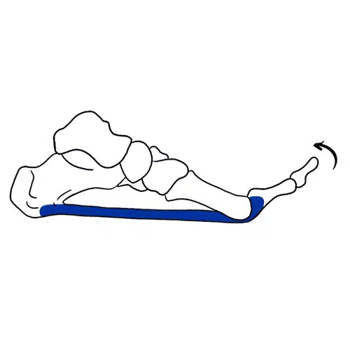 Diagram of Supinated foot